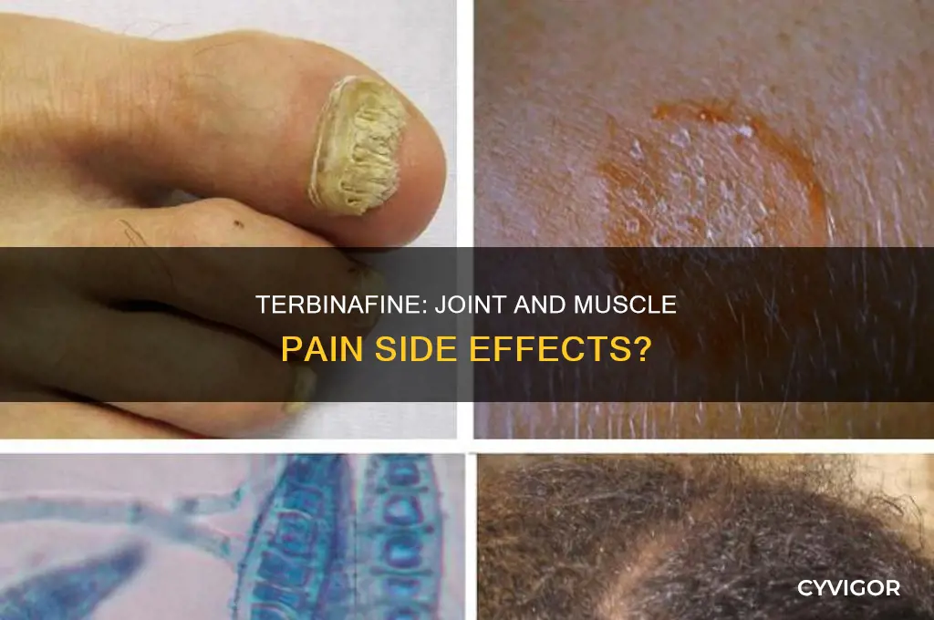 can terbenifine cause joints and muscle pain