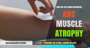 Flu-Induced Myositis: Can It Cause Muscle Atrophy?