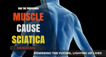 Piriformis Muscle: A Cause of Sciatica?
