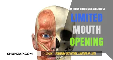 Thick Cheek Muscles: A Cause of Limited Mouth Opening?