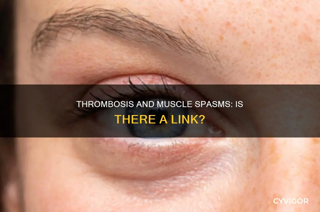 can thrombosis cause muscle spasms and nerve twitching