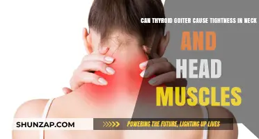 Thyroid Goiter: Understanding Neck and Head Muscle Tightness