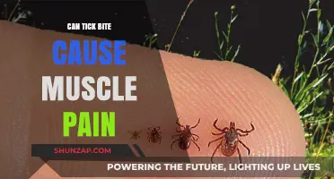 Tick Bite: Muscle Pain and Other Symptoms