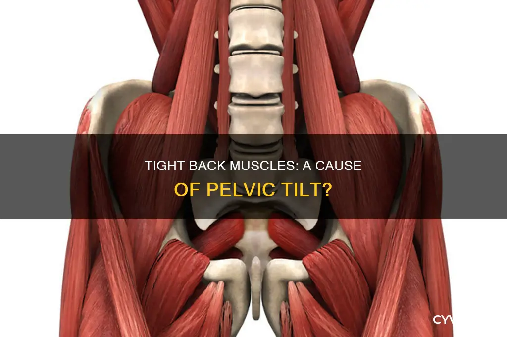 can tight back muscles cause pelvix tilt