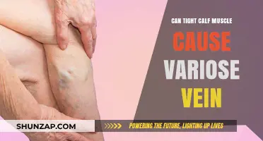 Tight Calf Muscles: A Cause of Varicose Veins?