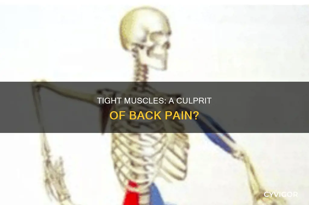 can tight muscles cause back pain