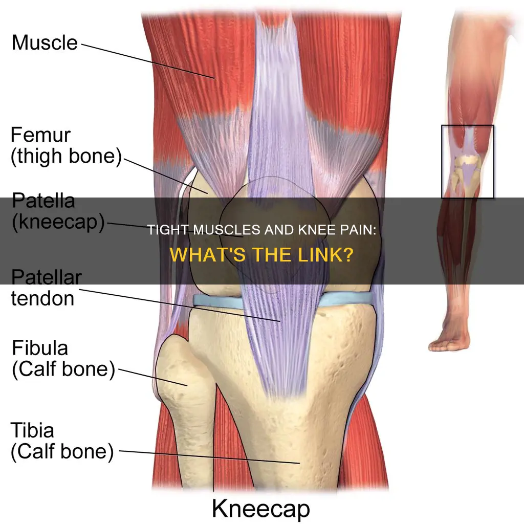 can tight muscles cause knee pain