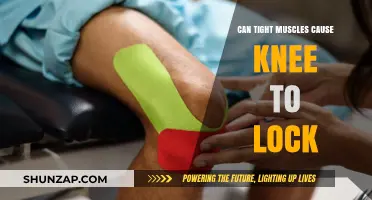 Tight Muscles: A Cause of Locked Knees?