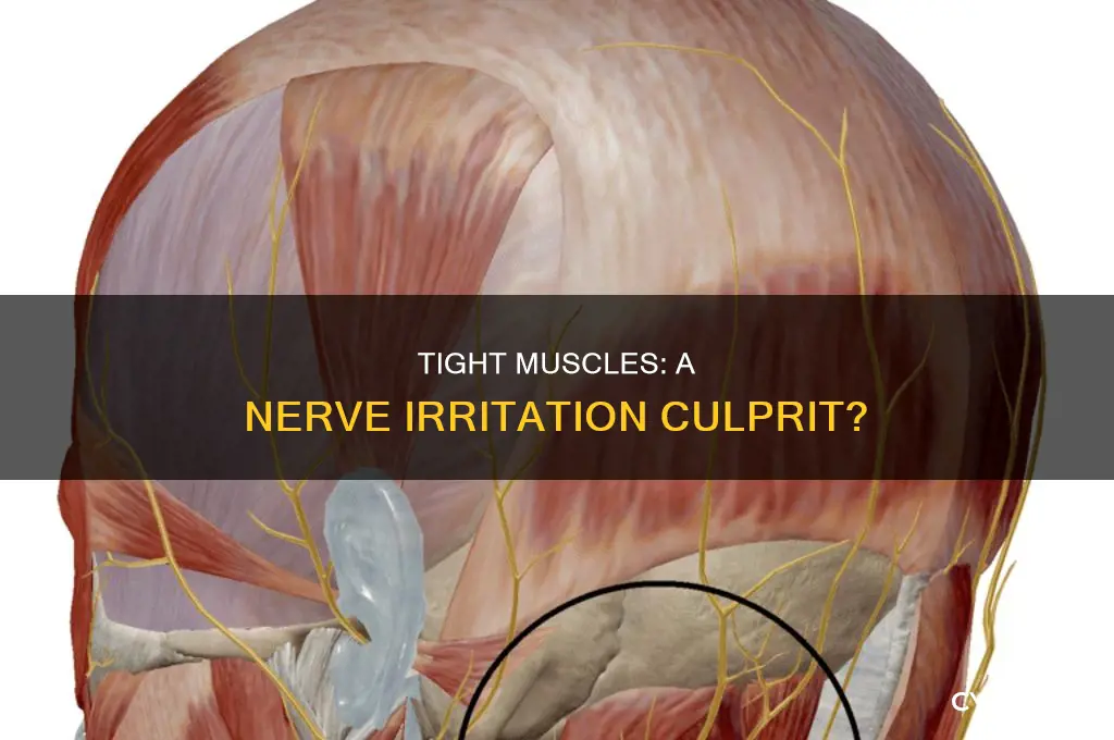 can tight muscles cause nerve irritation