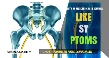 Tight Muscles: A Surprising Cause of Sciatica Symptoms