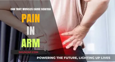 Tight Muscles: A Cause of Sciatica Arm Pain?