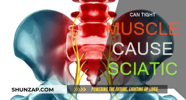 Tight Muscles: A Cause of Sciatica?