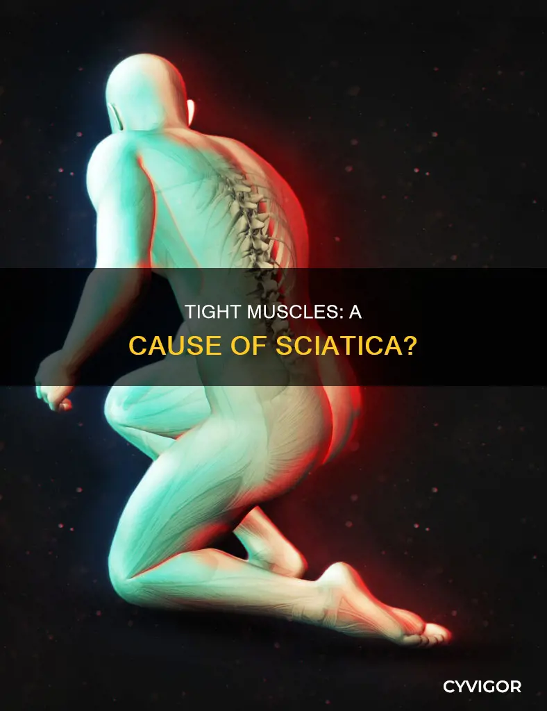can tight muscles cause sciatica