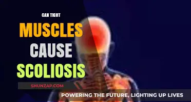 Tight Muscles: A Cause of Scoliosis?