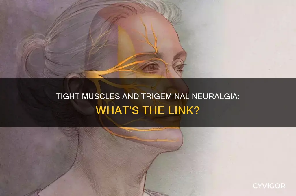 can tight muscles cause trigeminal neuralgia
