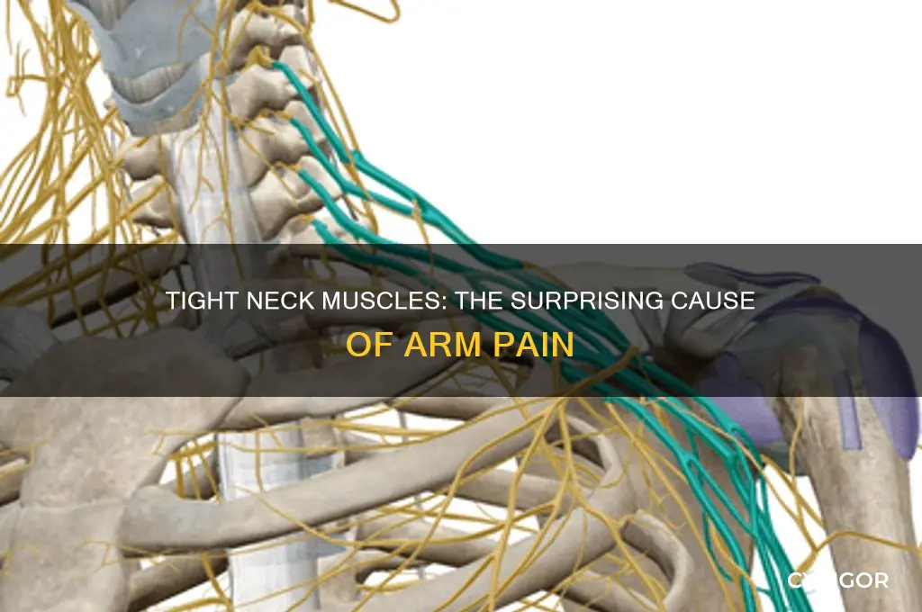 can tight neck muscles cause arm pain