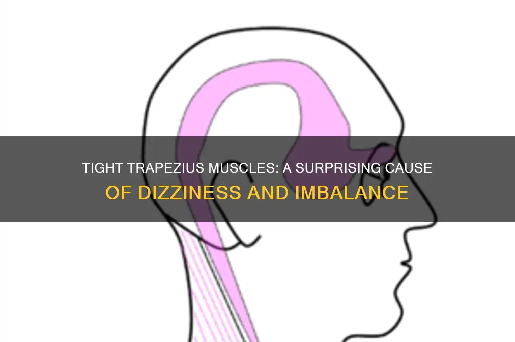 can tight trapezius muscles cause dizziness