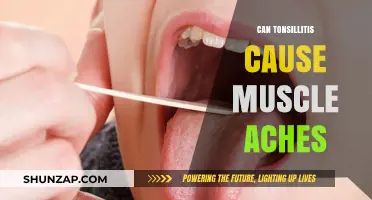 Tonsillitis: Muscle Aches and Other Surprising Symptoms