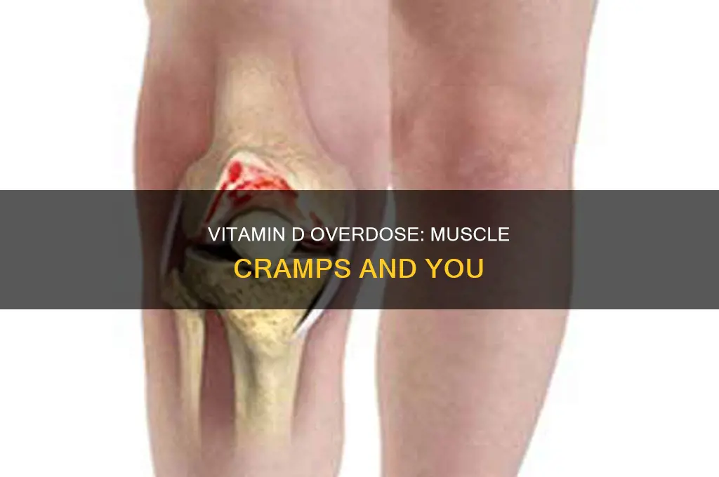 can too much vit d cause muscle cramps
