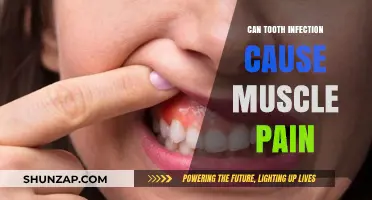 Tooth Infection and Muscle Pain: Is There a Link?