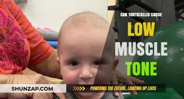 Torticollis: Low Muscle Tone Connection Explained