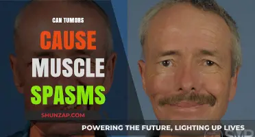 Muscle Spasms: A Tumor-Related Symptom?