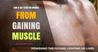 Muscle Growth and Stretch Marks: Understanding Skin Changes During Fitness Gains
