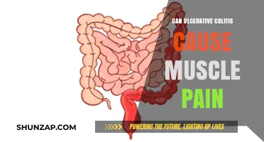 Ulcerative Colitis: Muscle Pain as a Symptom
