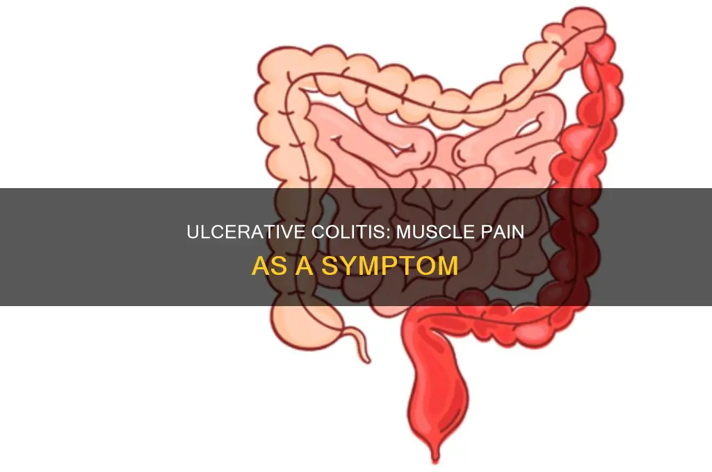 can ulcerative colitis cause muscle pain