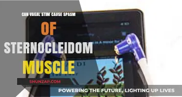 Vagal Stim and Sternocleidomastoid Spasms: What's the Link?