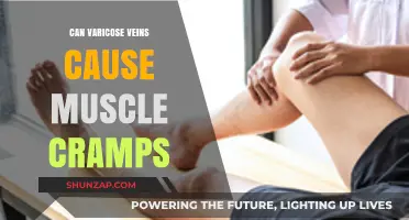 Varicose Veins and Muscle Cramps: Is There a Link?