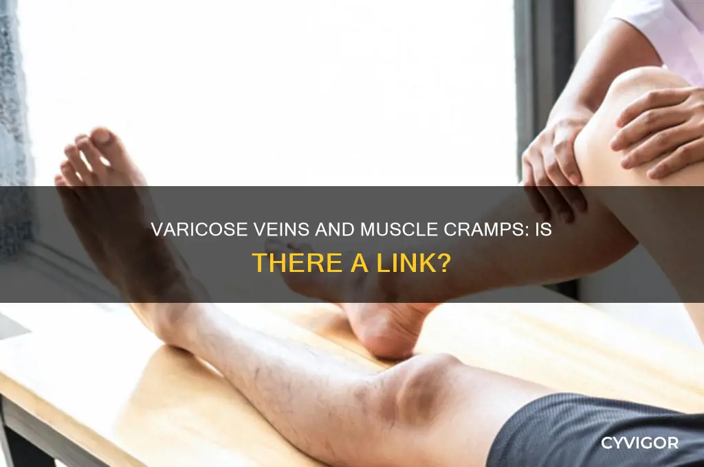 can varicose veins cause muscle cramps