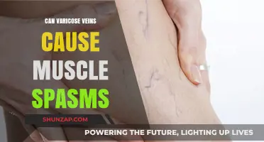 Varicose Veins and Muscle Spasms: Is There a Link?