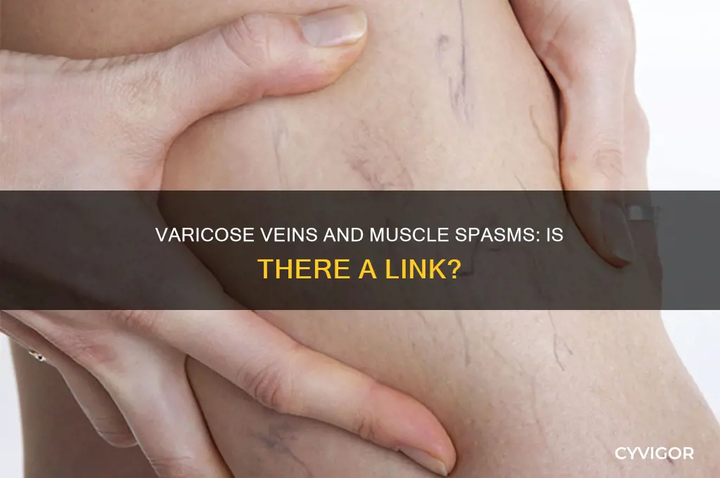 can varicose veins cause muscle spasms