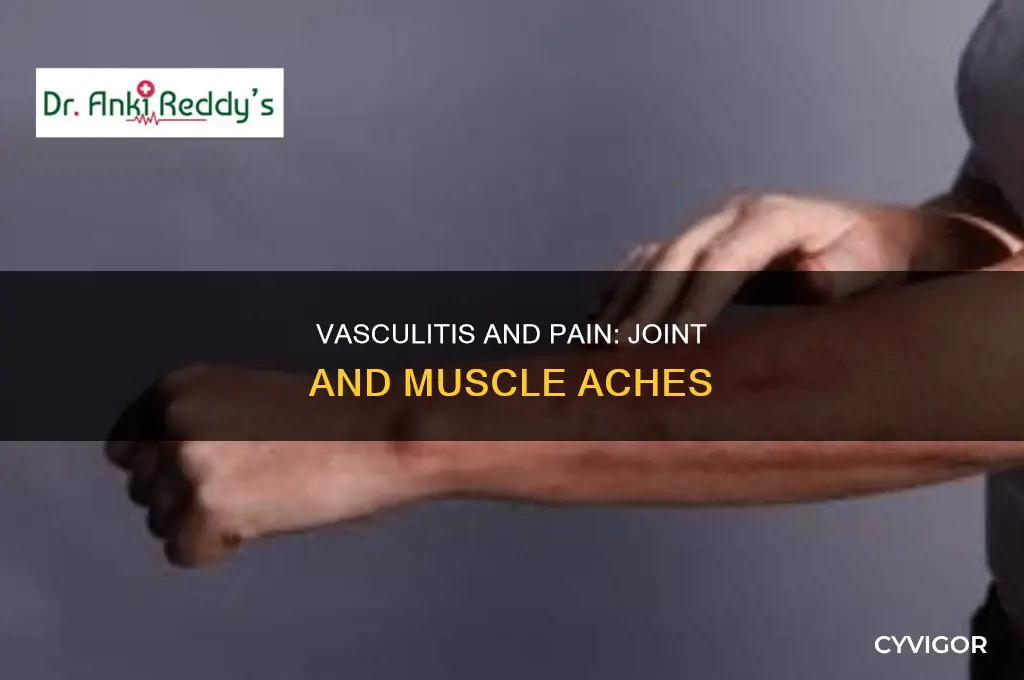 can vasculitis cause muscle and joint pain