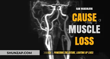 Vasculitis and Muscle Loss: Understanding the Link