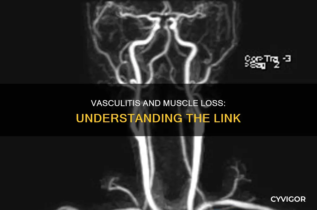 can vasculitis cause muscle loss
