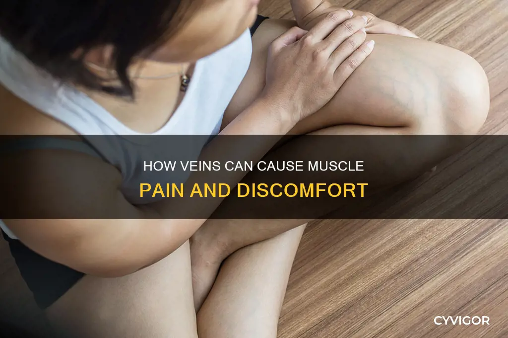can veins cause muscle pain