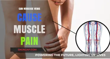 Varicose Veins and Muscle Pain: Is There a Link?