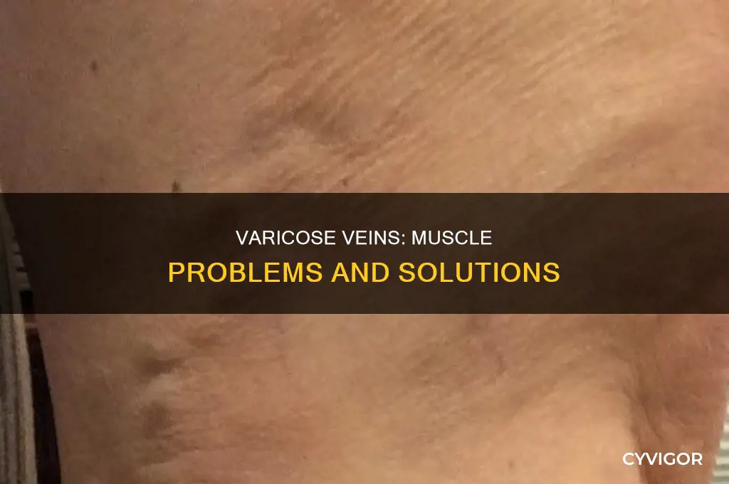 can vericus vein cause muscles probles