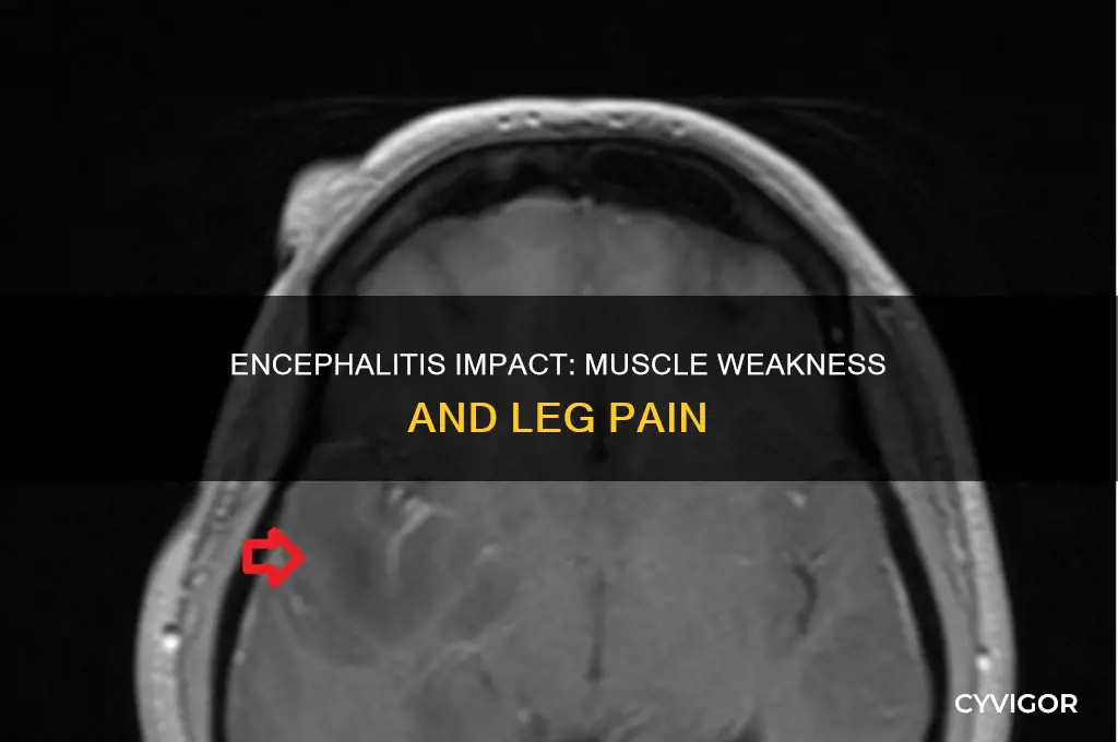 can viral encephalitis cause muscle weakness in the legs