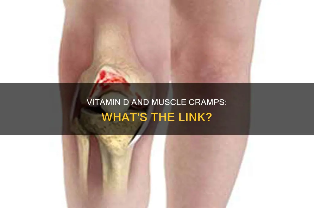 can vitamin d supplements cause muscle cramps