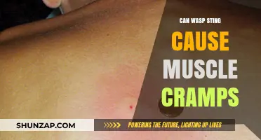 Wasp Stings: Muscle Cramps and Pain