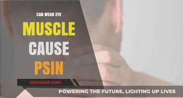 Eye Muscle Weakness: A Surprising Source of Pain