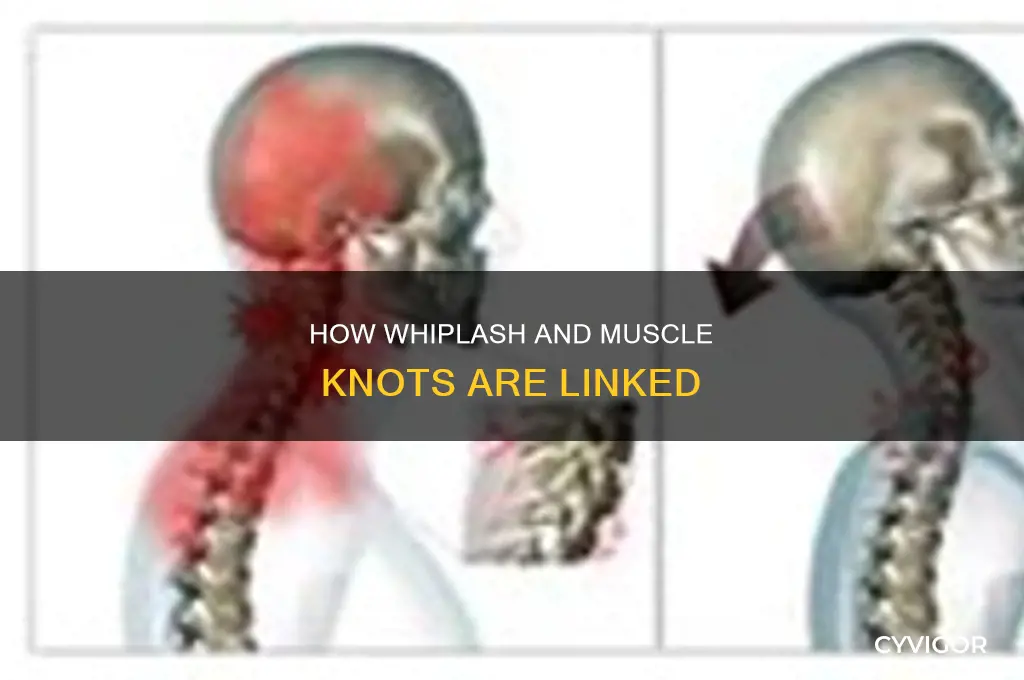 can whiplash cause muscle knots