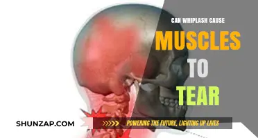 Whiplash and Muscle Tears: What's the Connection?