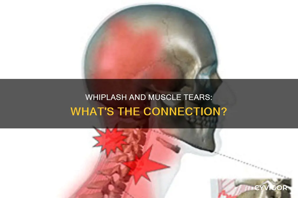 can whiplash cause muscles to tear