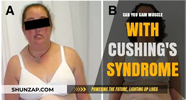 Building Muscle with Cushing's Syndrome: Challenges and Strategies for Success