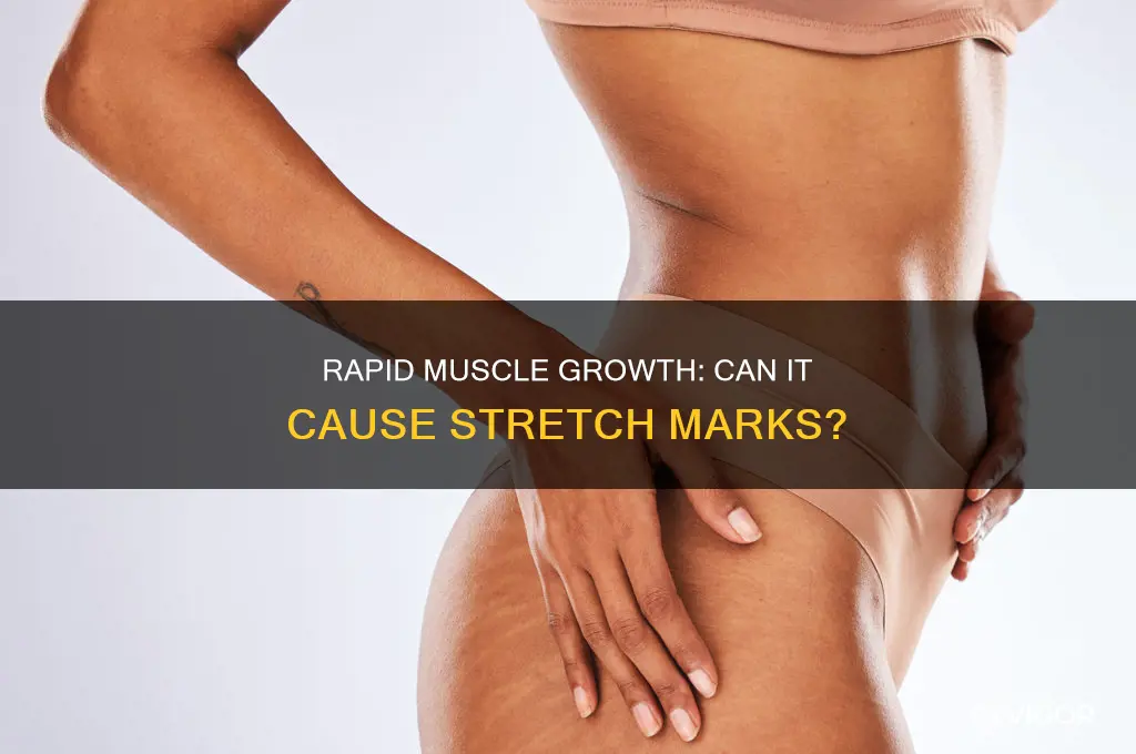 can you get stretch marks from gaining muscle too fast