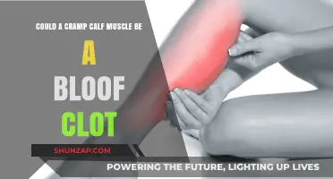 Could a Cramp in Your Calf Muscle Indicate a Blood Clot?